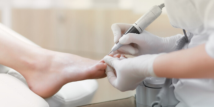 nagelpilz-fuspilz-vorbeugung-behandlung